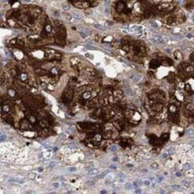 Immunohistochemistry-Paraffin: VAT1L Antibody [NBP3-17071] - Staining of human adrenal gland shows high expression.