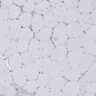 Immunohistochemistry-Paraffin: VAT1L Antibody [NBP3-17071] - Staining of human skeletal muscle shows low expression as expected.