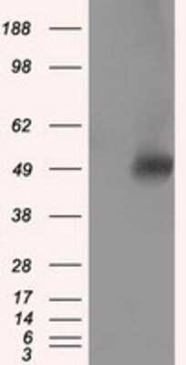 Western Blot: VAT1L Antibody (OTI1H3) - Azide and BSA Free [NBP2-74831] - HEK293T cells were transfected with the pCMV6-ENTRY control (Left lane) or pCMV6-ENTRY VAT1L (Right lane) cDNA for 48 hrs and lysed. Equivalent amounts of cell lysates (5 ug per lane) were separated by SDS-PAGE and immunoblotted with anti-VAT1L.