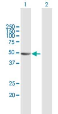 Western Blot: VAT1L Antibody [H00057687-B01P] - Analysis of KIAA1576 expression in transfected 293T cell line by KIAA1576 polyclonal antibody.  Lane 1: KIAA1576 transfected lysate(46.09 KDa). Lane 2: Non-transfected lysate.