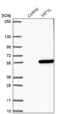Western Blot: VAT1L Antibody [NBP1-92570] - Analysis in control (vector only transfected HEK293T lysate) and VAT1L over-expression lysate (Co-expressed with a C-terminal myc-DDK tag (3.1 kDa) in mammalian HEK293T cells).