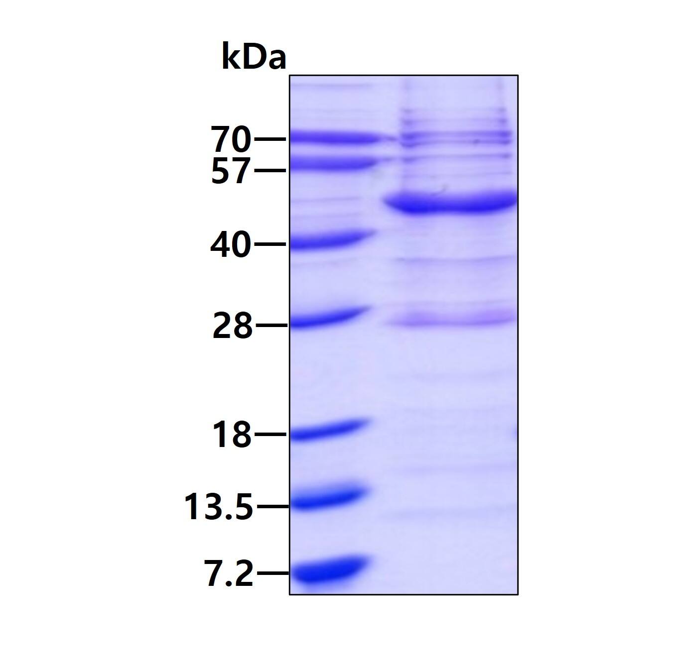 SDS-PAGE Recombinant Human Vav-1 His Protein