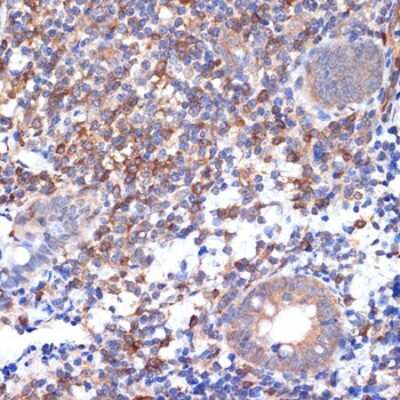 Immunohistochemistry-Paraffin: VAV2 Antibody (3S0O9) [NBP3-16218] - Immunohistochemistry of paraffin-embedded human appendix using VAV2 Rabbit mAb (NBP3-16218) at dilution of 1:100 (40x lens).Perform microwave antigen retrieval with 10 mM Tris/EDTA buffer pH 9.0 before commencing with IHC staining protocol.