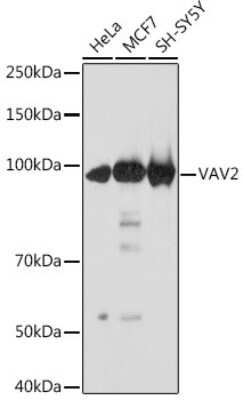 Western Blot: VAV2 Antibody (3S0O9) [NBP3-16218] - Western blot analysis of extracts of various cell lines, using VAV2 Rabbit mAb (NBP3-16218) at 1:1000 dilution. Secondary antibody: HRP Goat Anti-Rabbit IgG (H+L) at 1:10000 dilution. Lysates/proteins: 25ug per lane. Blocking buffer: 3% nonfat dry milk in TBST. Detection: ECL Basic Kit. Exposure time: 10s.