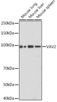 Western Blot: VAV2 Antibody (3S0O9) [NBP3-16218] - Western blot analysis of extracts of various cell lines, using VAV2 Rabbit mAb (NBP3-16218) at 1:1000 dilution. Secondary antibody: HRP Goat Anti-Rabbit IgG (H+L) at 1:10000 dilution. Lysates/proteins: 25ug per lane. Blocking buffer: 3% nonfat dry milk in TBST. Detection: ECL Basic Kit. Exposure time: 90s.