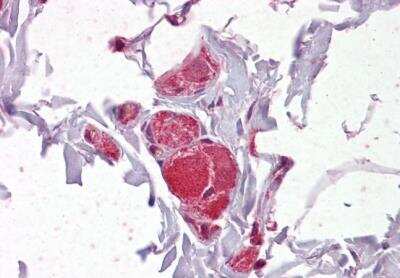 Immunohistochemistry-Paraffin: VAV2 Antibody [NB100-895] - Staining of paraffin embedded Human Colon. Steamed antigen retrieval with citrate buffer pH 6, AP-staining.