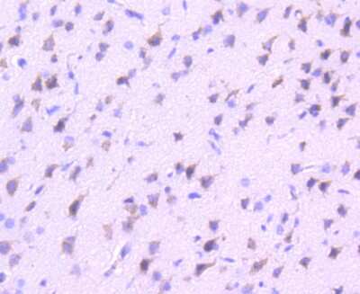 Immunohistochemistry-Paraffin: VAV2 Antibody (SC68-03) [NBP2-67623] - Analysis of paraffin-embedded rat brain tissue using anti-VAV2 antibody. Counter stained with hematoxylin.