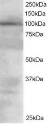 Western Blot: VAV2 Antibody [NB100-895] - Staining of 293 lysate (RIPA buffer, 30 ug total protein per lane). Primary incubated for 1 hour. Detected by western blot using chemiluminescence.