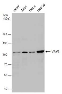 Western Blot: VAV2 Antibody [NBP3-13026] - VAV2 antibody detects VAV2 protein by western blot analysis. Various whole cell extracts (30 ug) were separated by 7.5% SDS-PAGE, and the membrane was blotted with VAV2 antibody (NBP3-13026) diluted at a dilution of 1:1000.