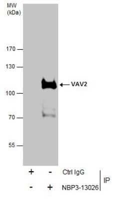 Western Blot: VAV2 Antibody [NBP3-13026] - Immunoprecipitation of VAV2 protein from HepG2 whole cell extracts using 5 ug of VAV2 antibody (NBP3-13026). Western blot analysis was performed using VAV2 antibody (NBP3-13026) diluted at 1:500. EasyBlot anti-Rabbit IgG was used as a secondary reagent.