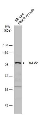 Western Blot: VAV2 Antibody [NBP3-13026] - Mouse tissue extract (50 ug) was separated by 7.5% SDS-PAGE, and the membrane was blotted with VAV2 antibody (NBP3-13026) diluted at 1:3000. The HRP-conjugated anti-rabbit IgG antibody (NBP2-19301) was used to detect the primary antibody.