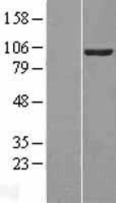 Western Blot: VAV2 Overexpression Lysate (Adult Normal) [NBL1-17702] Left-Empty vector transfected control cell lysate (HEK293 cell lysate); Right -Over-expression Lysate for VAV2.