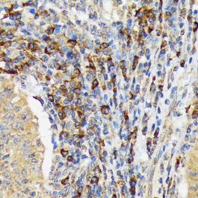 Immunohistochemistry-Paraffin VAV3 Antibody (9A10D8)