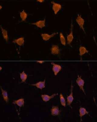 Immunocytochemistry/ Immunofluorescence VAV3 Antibody - Azide and BSA Free