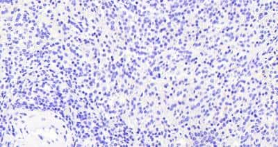 Immunohistochemistry-Paraffin VAV3 Antibody