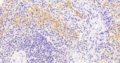 Immunohistochemistry-Paraffin VAV3 Antibody