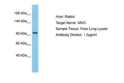 Western Blot: VAV3 Antibody [NBP2-86891] - Host: Rabbit. Target Name: VAV3. Sample Type: Fetal Lung. Antibody Dilution: 1.0ug/ml