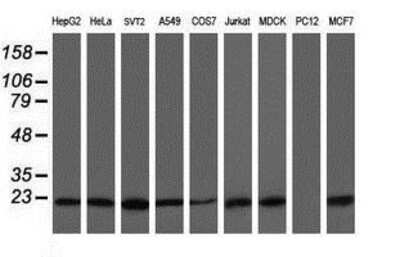 Western Blot: VBP1 Antibody (2A3) [NBP2-03754] Analysis of extracts (35ug) from 9 different cell lines by using anti-VBP1 monoclonal antibody (HepG2: human; HeLa: human; SVT2: mouse; A549: human; COS7: monkey; Jurkat: human; MDCK: canine; PC12: rat; MCF7: human).