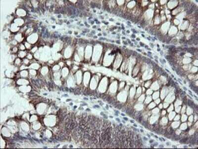 Immunohistochemistry: VBP1 Antibody (2E6) [NBP2-46329] - Analysis of Human colon tissue.