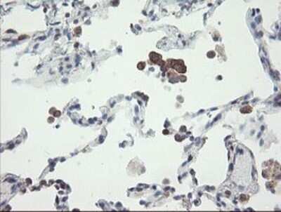 Immunohistochemistry: VBP1 Antibody (2E6) [NBP2-46329] - Analysis of Human lung tissue.