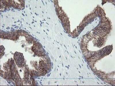 Immunohistochemistry: VBP1 Antibody (2E6) [NBP2-46329] - Analysis of Human prostate tissue.