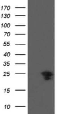 Western Blot: VBP1 Antibody (2E6) [NBP2-46329] - Analysis of HEK293T cells were transfected with the pCMV6-ENTRY control (Left lane) or pCMV6-ENTRY VBP1.