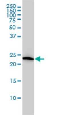 Western Blot: VBP1 Antibody (3D11) [H00007411-M01] - VBP1 monoclonal antibody (M01), clone 3D11 Analysis of VBP1 expression in HL-60.