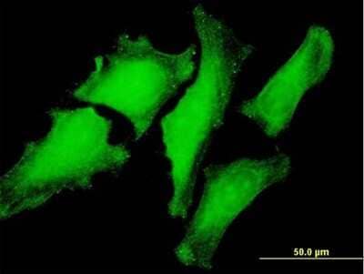 Immunocytochemistry/Immunofluorescence: VBP1 Antibody [H00007411-B01P] - Analysis of purified antibody to VBP1 on HeLa cell. (antibody concentration 10 ug/ml)