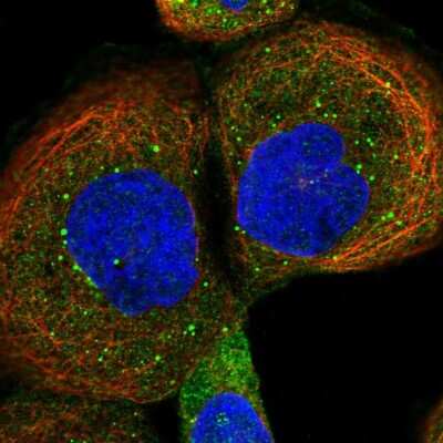 Immunocytochemistry/Immunofluorescence: VBP1 Antibody [NBP1-80922] - Immunofluorescent staining of human cell line A-431 shows localization to cytosol & vesicles.