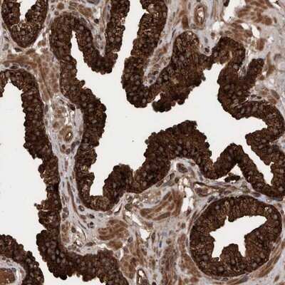 Immunohistochemistry-Paraffin: VBP1 Antibody [NBP1-80922] - Staining of human prostate shows strong cytoplasmic positivity in glandular cells.