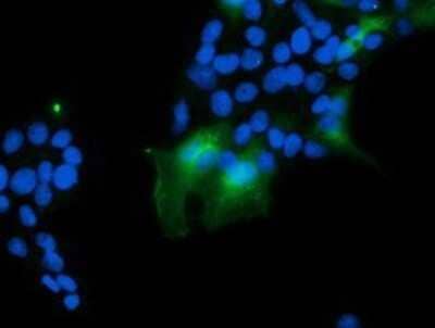 Immunocytochemistry/Immunofluorescence: VBP1 Antibody (OTI2A3) - Azide and BSA Free [NBP2-74833] - Staining of COS7 cells transiently transfected by pCMV6-ENTRY VBP1.