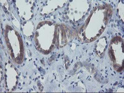 Immunohistochemistry: VBP1 Antibody (OTI2A3) - Azide and BSA Free [NBP2-74833] - Staining of paraffin-embedded Human Kidney tissue using anti-VBP1 mouse monoclonal antibody.