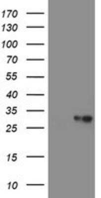 Western Blot: VBP1 Antibody (OTI2A3) - Azide and BSA Free [NBP2-74833] - HEK293T cells were transfected with the pCMV6-ENTRY control (Left lane) or pCMV6-ENTRY VBP1 (Right lane) cDNA for 48 hrs and lysed. Equivalent amounts of cell lysates (5 ug per lane) were separated by SDS-PAGE and immunoblotted with anti-VBP1.