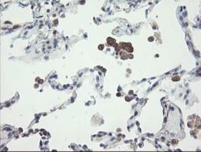 Immunohistochemistry: VBP1 Antibody (OTI2E6) - Azide and BSA Free [NBP2-74836] - Analysis of Human lung tissue.