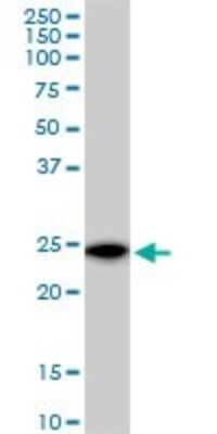 Western Blot: VBP1 Antibody [H00007411-B01P] - Analysis of VBP1 expression in HeLa.