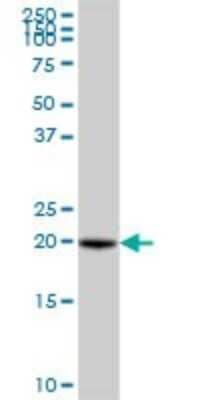 Western Blot: VBP1 Antibody [H00007411-B01P] - Analysis of VBP1 expression in human placenta.