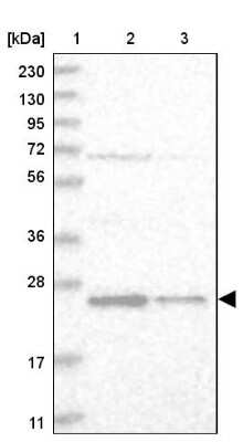 Western Blot: VBP1 Antibody [NBP1-80922] - Lane 1: Marker  [kDa] 230, 130, 95, 72, 56, 36, 28, 17, 11.  Lane 2: Human cell line RT-4.  Lane 3: Human cell line U-251MG sp