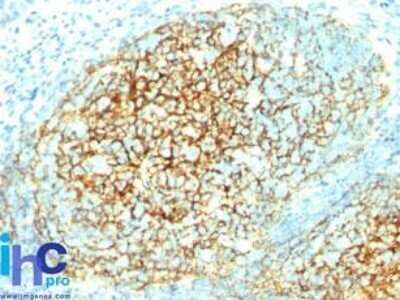 Immunohistochemistry-Paraffin: VCAM-1/CD106 Antibody (1.4C3) - IHC-Prediluted [NBP2-48171] - Formalin-fixed, paraffin-embedded human tonsil stained with VCAM1 / CD106 antibody at 1:100 using peroxidase-conjugate and DAB chromogen. Note membrane staining.