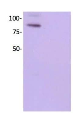 Western Blot: VCAM-1/CD106 Antibody (1.4C3) [NBP2-29413] - Analysis using the HRP conjugate of NBP2-29413. Detection of VCAM-1 in HDMVE cell lysate using anti-VCAM-1 antibody. Image from verified customer review.