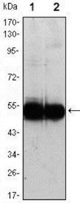 Western Blot: VCAM-1/CD106 Antibody (6G9) - Azide and BSA Free [NBP2-81005] - Using VCAM1 mouse mAb against (1) HUVEC and (2) EC cell lysate. Image from the standard format of this antibody.