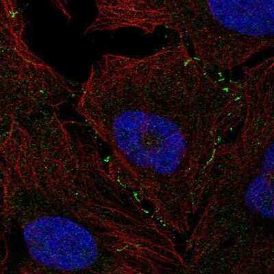 Immunocytochemistry/Immunofluorescence: VCAM-1/CD106 Antibody [NBP2-55858] - Staining of human cell line U-2 OS shows localization to cell junctions. Antibody staining is shown in green.