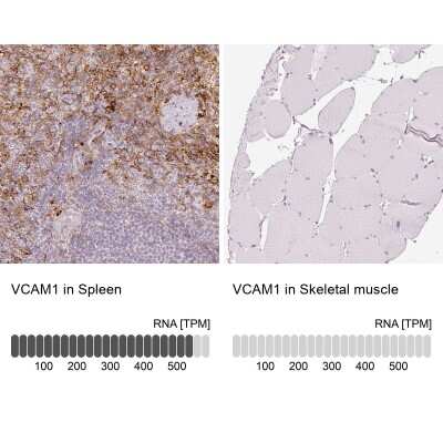 Immunohistochemistry-Paraffin: VCAM-1/CD106 Antibody [NBP2-38223] - Analysis in human spleen and skeletal muscle tissues. Corresponding VCAM1 RNA-seq data are presented for the same tissues.