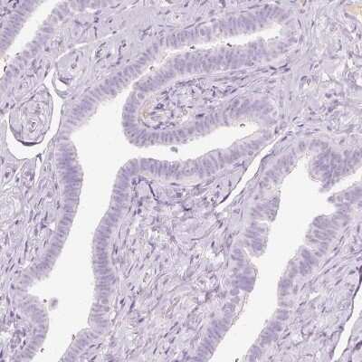 Immunohistochemistry-Paraffin: VCAM-1/CD106 Antibody [NBP2-38223] - Staining of human Fallopian tube shows no positivity in glandular cells.