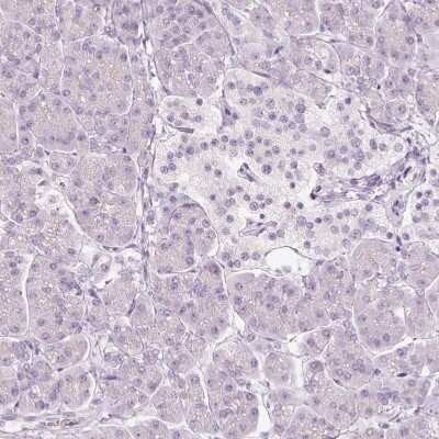 Immunohistochemistry-Paraffin: VCAM-1/CD106 Antibody [NBP2-38223] - Staining of human pancreas shows no positivity in exocrine glandular cells or in islets of Langerhans.