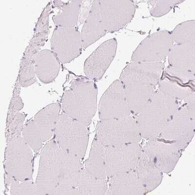 Immunohistochemistry-Paraffin: VCAM-1/CD106 Antibody [NBP2-38223] - Staining of human skeletal muscle shows no positivity in myocytes.