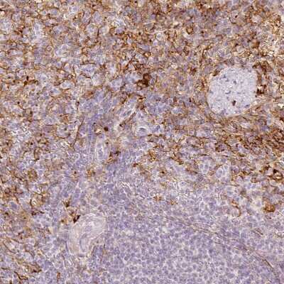 <b>Orthogonal Strategies Validation. </b>Immunohistochemistry-Paraffin: VCAM-1/CD106 Antibody [NBP2-38223] - Staining of human spleen shows strong membranous positivity in cells in red pulp.