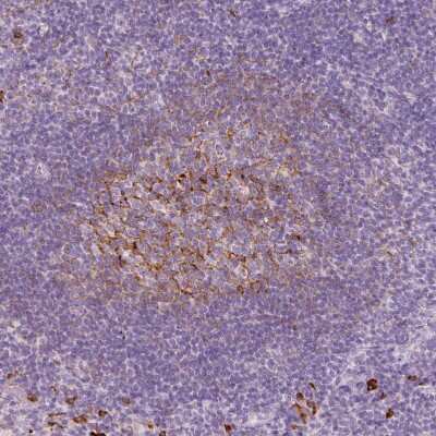 Immunohistochemistry-Paraffin: VCAM-1/CD106 Antibody [NBP2-38223] - Staining of human tonsil shows moderate membranous positivity in germinal center cells.