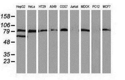 Western Blot: VCAM-1/CD106 Antibody (OTI3H10) - Azide and BSA Free [NBP2-74840] - Analysis of extracts (35ug) from 9 different cell lines by using anti-VCAM1 monoclonal antibody.