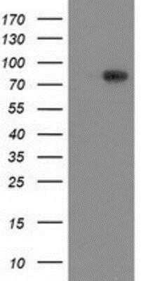 Western Blot: VCAM-1/CD106 Antibody (OTI3H10) - Azide and BSA Free [NBP2-74840] - HEK293T cells were transfected with the pCMV6-ENTRY control (Left lane) or pCMV6-ENTRY VCAM1 (Right lane) cDNA for 48 hrs and lysed. Equivalent amounts of cell lysates (5 ug per lane) were separated by SDS-PAGE and immunoblotted with anti-VCAM1.