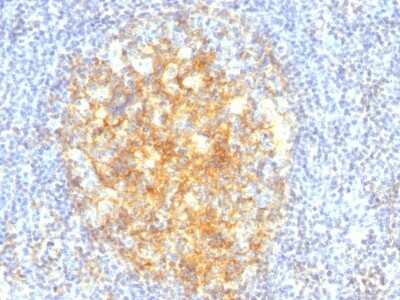 Immunohistochemistry-Paraffin: VCAM-1/CD106 Antibody (VCAM1/843) [NBP2-44615] - Human Tonsil stained with CD106 Monoclonal Antibody (VCAM1/843).